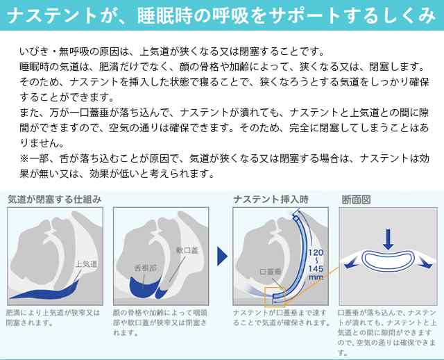 ナステント クラッシックnastent classic 5箱×7本 - 衛生日用品