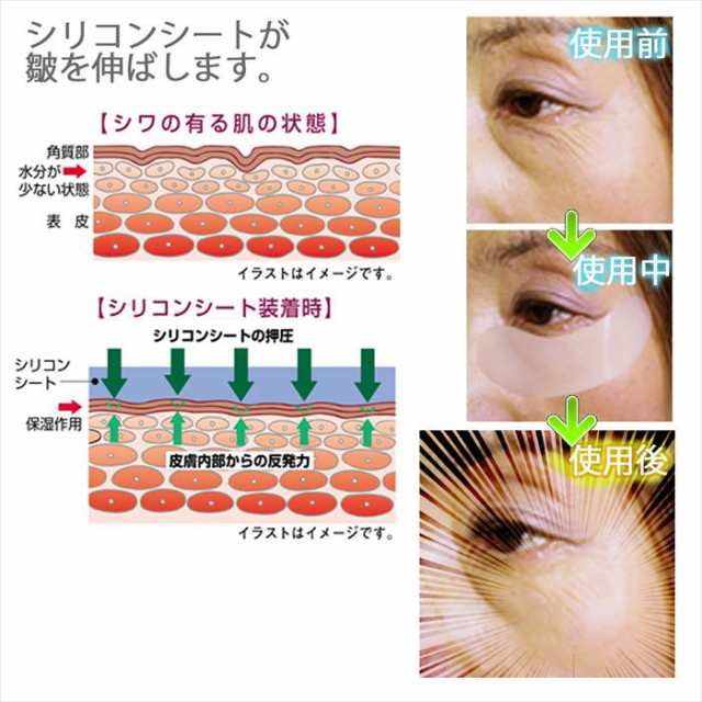 皺取麗子 シリコンシート ほうれい線用 安全のシリコン素材 経済的 繰り返し使用 メール便送料無料 の通販はau Pay マーケット みもざの庭