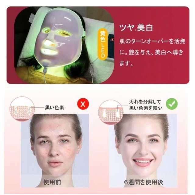 LED美顔マスク 美顔器 光エステ 温熱ケア LED 美肌 ニキビ対策 毛穴