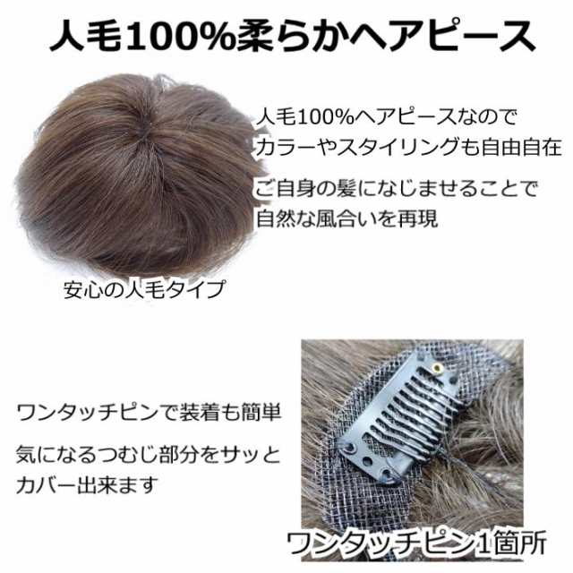 部分ウィッグ ヘアピース 人工毛 I型つむじ 脱毛 医療 髪 ブラウン