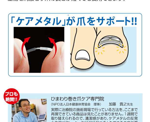 オーバーのアイテム取扱☆ 巻き爪シール 巻き爪 矯正 ワイヤー 形状記憶 まきづめ 巻きづめ メール便 爪 つめ 暮らしの幸便 