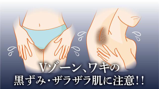 薬用 ピーリング ピーリングジェル 黒ずみ 黒ずみ対策 Vゾーン 脇 ワキ ザラザラ ジェル ツルツル デリケートゾーン専用 ナチュラル 日本の通販はau Pay マーケット ヴィヴィアン マルシェ Au Pay マーケット店