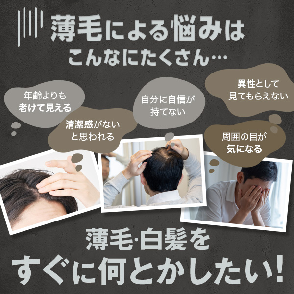 チャップアップ　モアシーラー　150g　3個セット Amazon.co.jp: チャップアップ モアシーラー 150g (白髪隠し