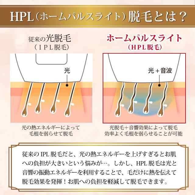 新しいコレクション センスエピ☆家庭用フラッシュ脱毛器の センスエピ