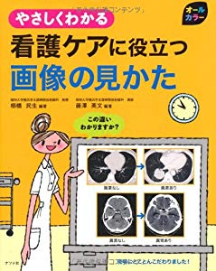 やさしくわかる看護ケアに役立つ画像の見かた 中古品 の通販はau Pay マーケット ふら ふらっと Au Pay マーケット店