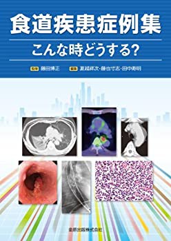 【未使用】【中古】 食道疾患症例集 こんな時どうする?