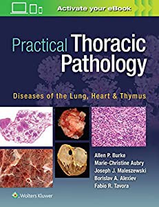 Practical Thoracic Pathology: Diseases of the Lung%ｶﾝﾏ% Heart%ｶﾝﾏ% and Thymus(中古品)