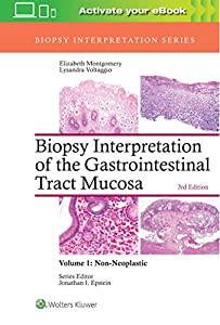 Biopsy Interpretation of the Gastrointestinal Tract Mucosa: Volume 1: Non-Neoplastic (Biopsy Interpretation Series)(中古