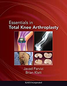 Essentials in Total Knee Arthroplasty (Parvizi%ｶﾝﾏ% Essentials in Total Knee Arthroplasty)(中古品)