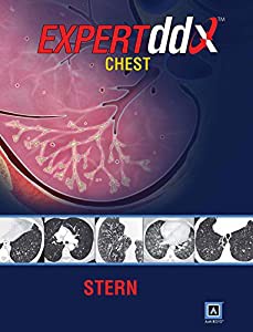 EXPERTddx?: Chest(中古品)