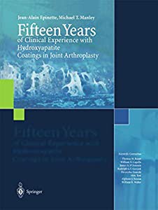 Fifteen Years of Clinical Experience with Hydroxyapatite Coatings in Joint Arthroplasty(中古品)