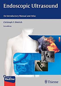 Endoscopic Ultrasound: An Introductory Manual and Atlas(中古品)