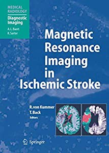 Magnetic Resonance Imaging in Ischemic Stroke (Medical Radiology)(中古品)