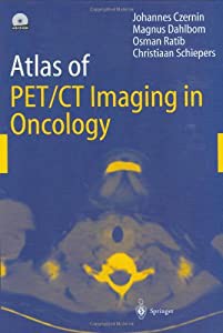 Atlas Of PET/CT Imaging In Oncology(中古品)