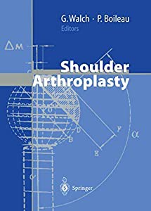 Shoulder Arthroplasty(中古品)