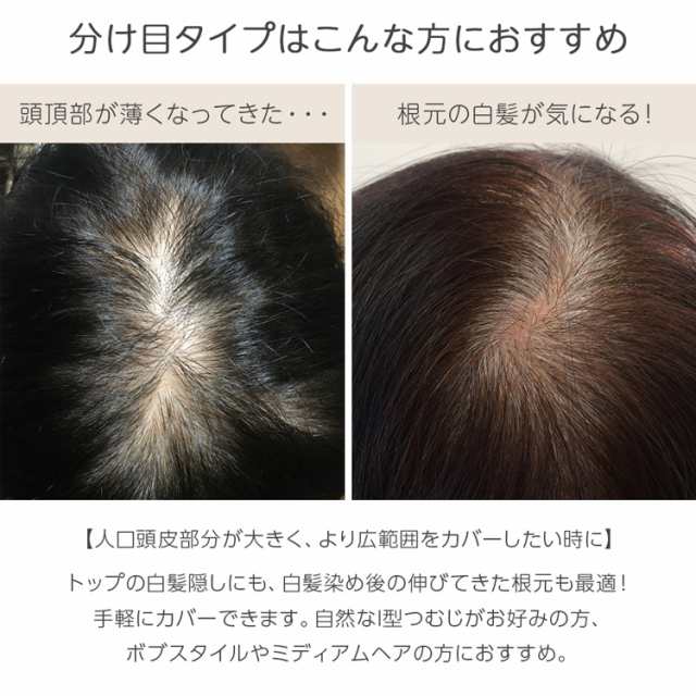 返品OK】2サイズ 部分 ウィッグ 人毛 人毛100% トップヘアピース 医療 ...