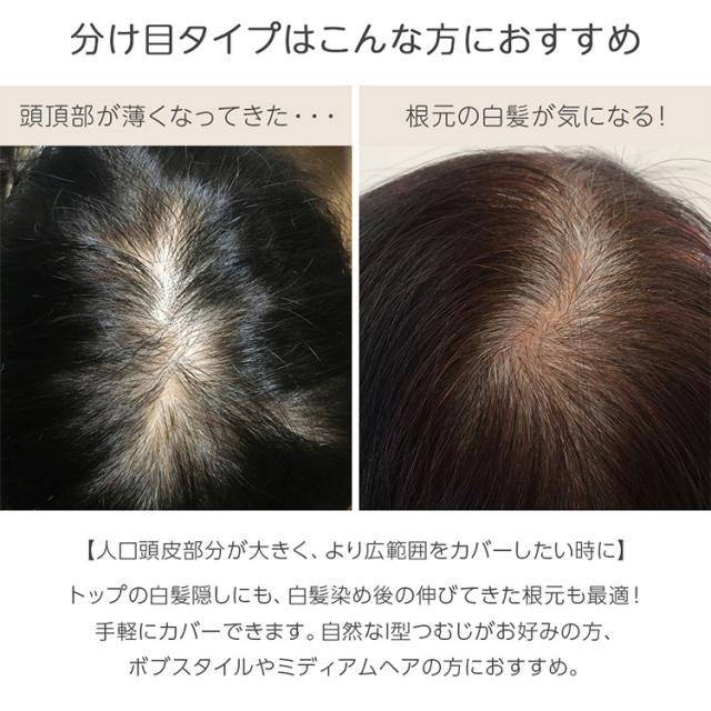トップカバー 20cm 部分手植え レミー 人毛100% 部分ウィッグ 自然