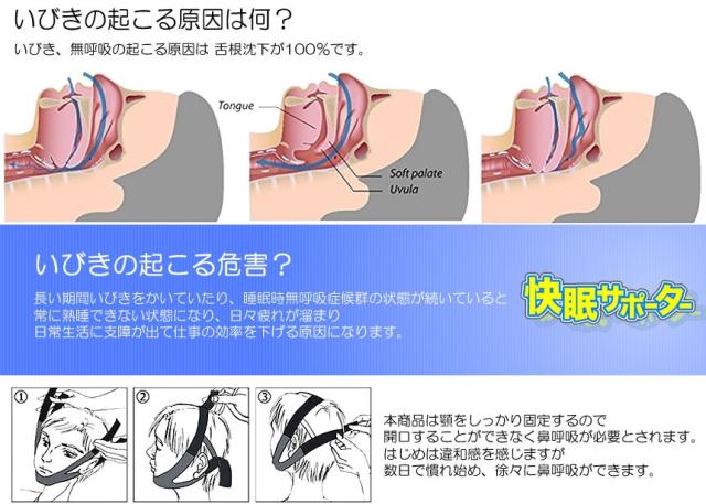 快眠サポーター いびき 矯正 鼻呼吸促進 寝具 歯ぎしり 解消 鼻呼吸矯正 小顔矯正 顎関節症 簡単脱着 Tec Kaisapodの通販はau Pay マーケット Pcbox78 快眠サポーター いびき 矯正 鼻呼吸促進 寝具 歯ぎしり 解消 鼻呼吸矯正 小顔矯正 顎関節症 簡単脱着 Tec Kaisapodの通販はau Pay マーケット Pcbox78