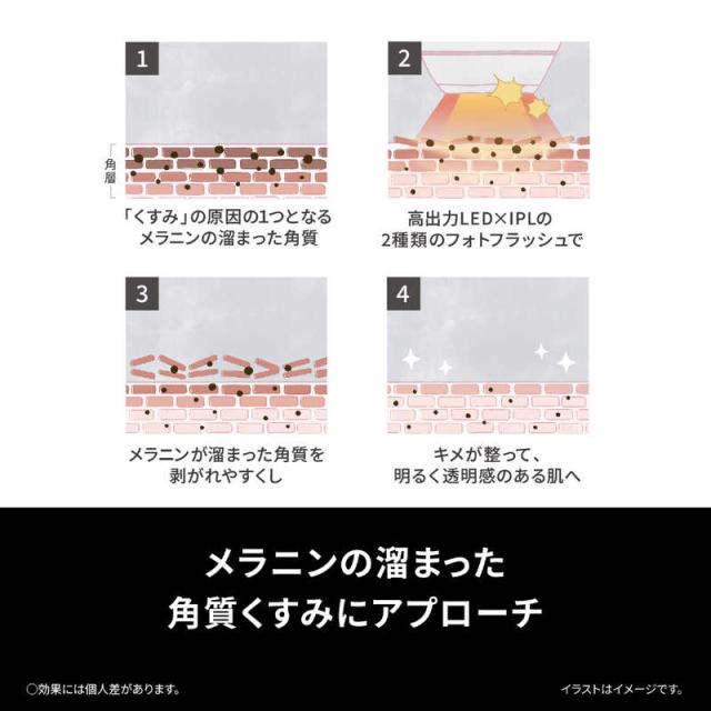 パナソニック　Panasonic　光美顔器 フォト ブライトショット ホワイト[LED美顔器/国内・海外対応]　EH-SL85-W_5