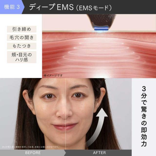 MiRAY ONE 美顔器 MT-MRO-24W MYTREX マルチヘッド美顔器 MiRAY ONE(マイトレックス ミライワン