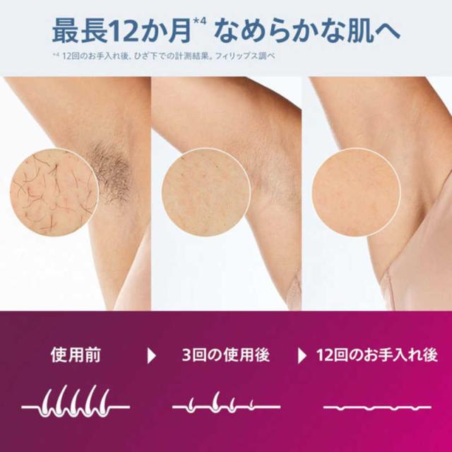 フィリップス PHILIPS 家庭用脱毛器 ルメア 光美容器 8000 ［AC100V
