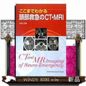 ここまでわかる頭部救急のCT・MRI