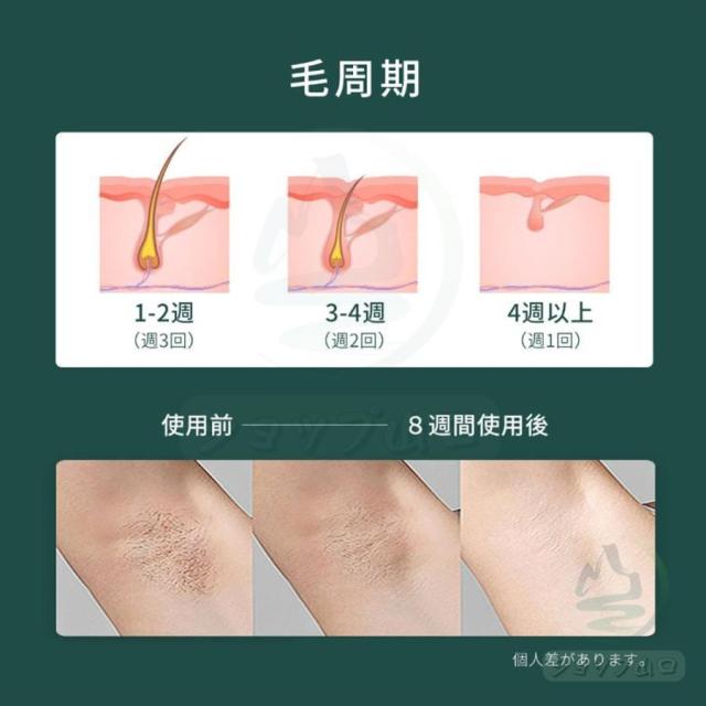 脱毛器 ipl光脱器 無痛脱毛器 サロン級 女性 メンズ 5段階調節 自動照射 レーザー vio対応 メンズ レディース 脇 腕 足 背中 全身用 家庭用 全身快速脱毛 除毛