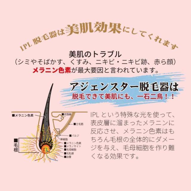 脱毛器 IPL光脱器 永久脱毛 家庭用脱毛器 自動照射 レーザー vio対応 メンズ レディース 脇 腕 足 背中 全身用 LED液晶 全身適用