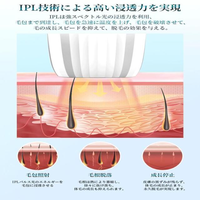 脱毛器 IPL光脱器 永久脱毛 家庭用脱毛器 自動照射 レーザー vio対応 メンズ レディース 脇 腕 足 背中 全身用 LED液晶 全身適用