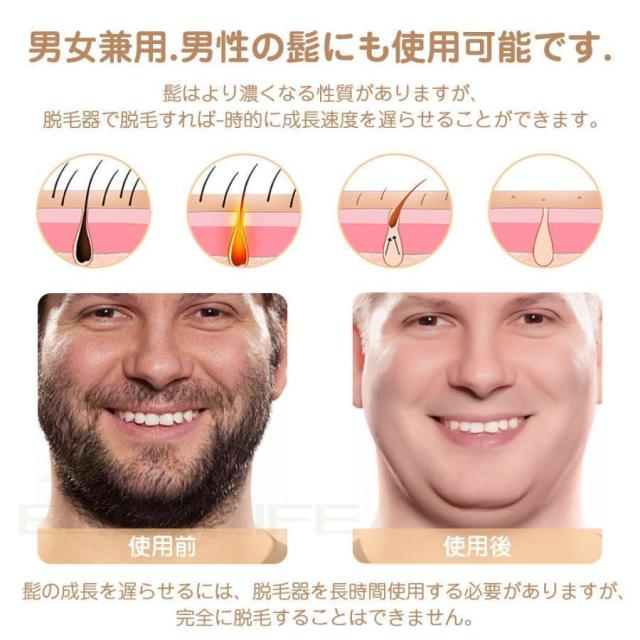 脱毛器 メンズ 髭 女性 vio対応 冷感 IPL光美容器 サロン級 髭 ヒゲ ムダ毛処理 フラッシュ自動 連射 5段階レベル 脱毛機 美肌 プレゼント