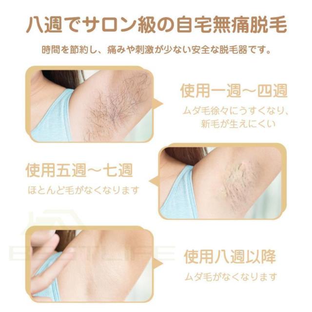 脱毛器 メンズ 髭 女性 vio対応 冷感 IPL光美容器 サロン級 髭 ヒゲ ムダ毛処理 フラッシュ自動 連射 5段階レベル 脱毛機 美肌 プレゼント