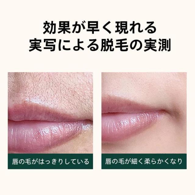 IPL脱毛器 家庭用 脱毛器 女性 光美容器 氷感 高性能 美肌 ひげ ヒゲ 脚 腕 顔 自宅 全身適用 男女兼用 高級 最新式 おすすめ