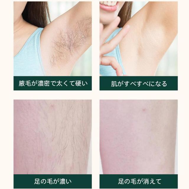 IPL脱毛器 家庭用 脱毛器 女性 光美容器 氷感 高性能 美肌 ひげ ヒゲ 脚 腕 顔 自宅 全身適用 男女兼用 高級 最新式 おすすめ