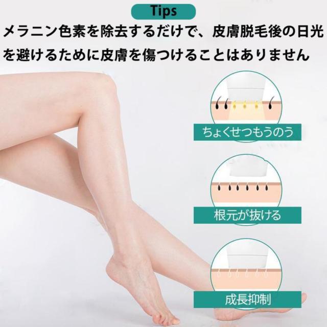 脱毛器 家庭用脱毛 脱毛機 永久 全身適用 氷感 99万発 男女兼用 5段階調節 光美容器 光脱毛器 vio対応 無痛脱毛器 家庭用 自宅 高級 おすすめ プレゼント