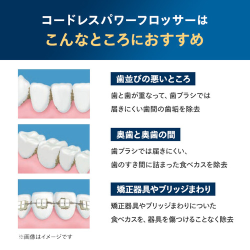 PHILIPS HX3826／31 ソニッケアーコードレスPF3000ホワイト_4