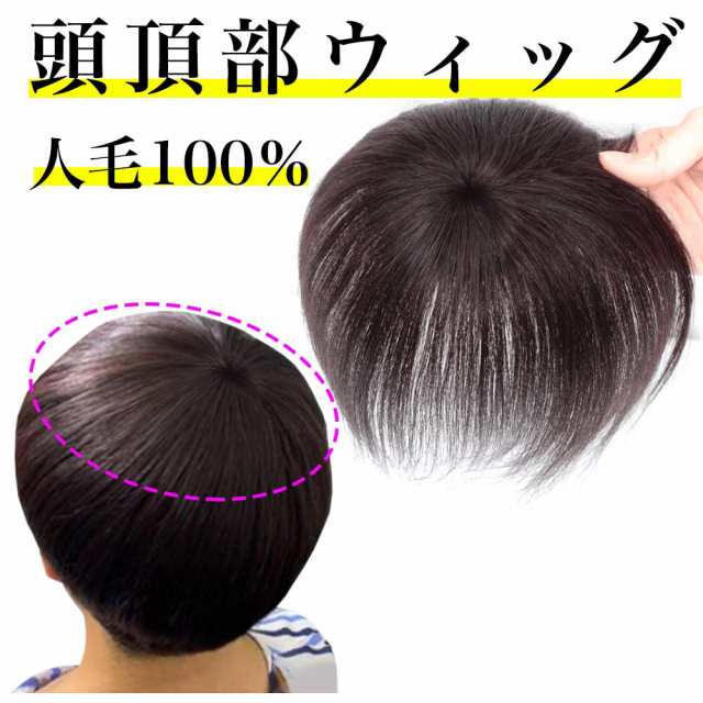 つむじ 頭頂部 ウィッグ ヘアピース 部分かつら 薄毛 - ウィッグ・エクステ