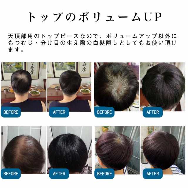 ヘアピース 頭頂部 ウィッグ 人毛100％ 自然 つむじ ショート ストレート 通気性 前髪あり 薄毛 脱毛 白髪 部分ウィッグ トップウィッグ  の通販はau PAY マーケット - OASIS-MART | au PAY マーケット－通販サイト