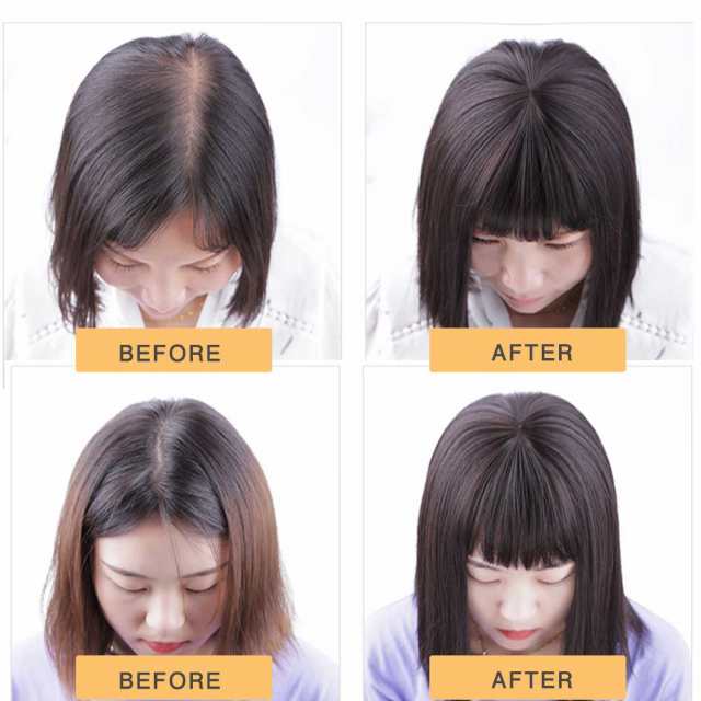 Amazon.co.jp: ヘアピース つむじ 人毛100% 頭頂部 ウィッグ