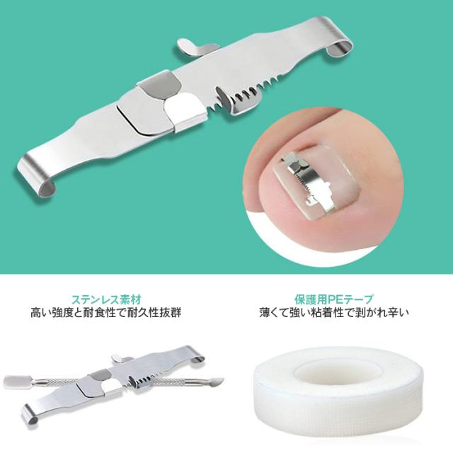 巻き爪ケアクリップ クリップ ワイヤー ガード 爪ブロック テープ 巻きづめ 靴 巻爪 対策 足の巻き爪 防止 テーピング サポーター 矯正 の通販はau Pay マーケット Ohplus Au Pay マーケット店