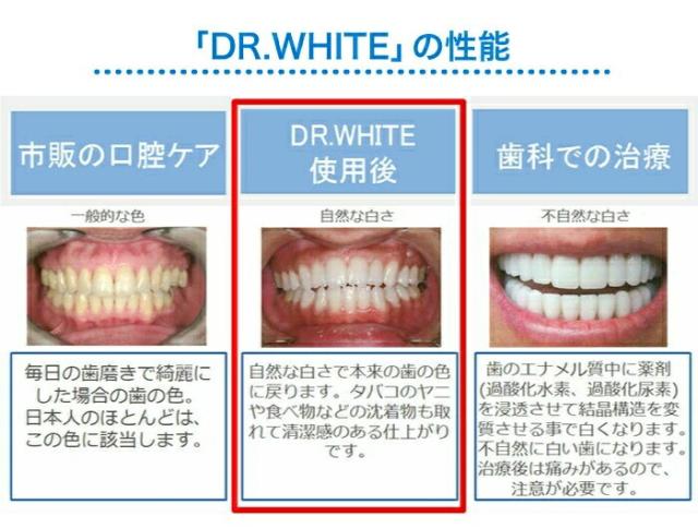 ドクターホワイト DR.WHITE 有吉ジャポンにて紹介！ 歯の 