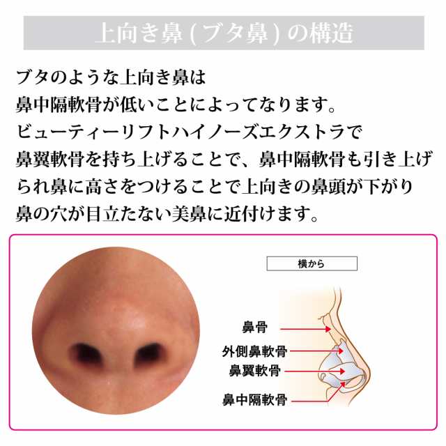 三太郎の日 会員限定クーポン 鼻プチ 美顔器 リフトアップ 低い鼻 だんご鼻 ワシ鼻 にんにく鼻 鼻筋 美鼻 矯正 プチ整形 小鼻 ビューの通販はau Pay マーケット M Trade