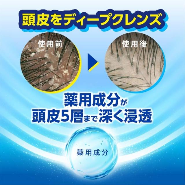 h&s エイチアンドエス モイスチャー シャンプー つめかえ 詰替 超特大