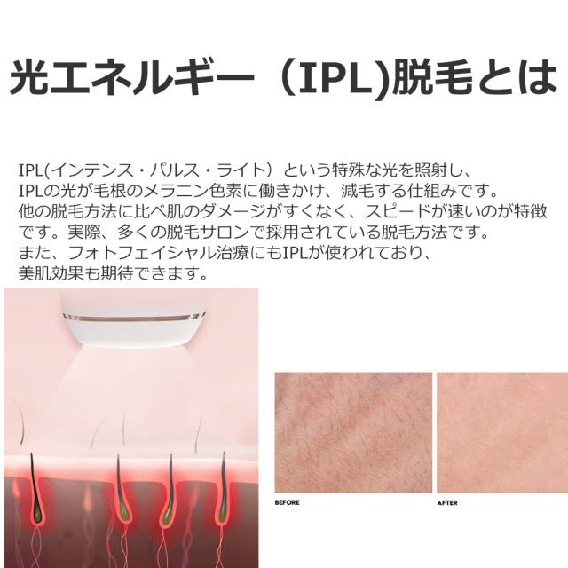 脱毛器 最新型 光脱毛 全身対応 Vio ひげ Ipl脱毛 メンズ 男性 ムダ毛 背中 デリケートゾーン 顔 女性 レディース 子供 家庭用 髭 脇の通販はau Pay マーケット Agenstar アジェンスター