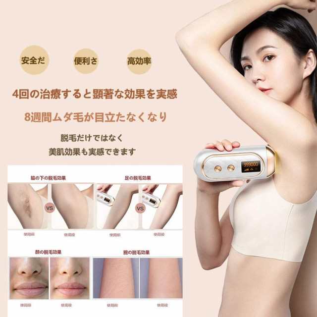 脱毛器 メンズ 脱毛 レーザー 永久脱毛 ipl 光脱毛器 光エステ vio 髭 脇 全身 家庭用 ムダ毛処理 PSE認証済み脱毛器具 むだげ処理  男性｜au PAY マーケット