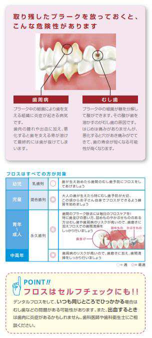 送料無料（メール便）ＧＣジーシー ルシェロフロス30ｍ ミントワックス パープル 6個セットの通販はau PAY マーケット - プロマ歯科商店