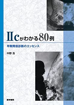 2cがわかる80例—早期胃癌診断のエッセンス(中古品)の通販は