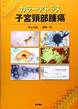 カラーアトラス 子宮頸部腫瘍(未使用 未開封の中古品)の通販は 11,365円