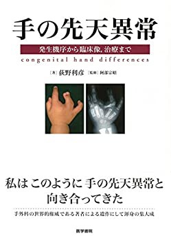 手の先天異常: 発生機序から臨床像%ｶﾝﾏ%治療まで(未使用 未開封の中古品)