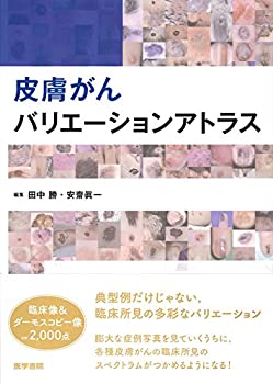 皮膚がんバリエーションアトラス(中古品)