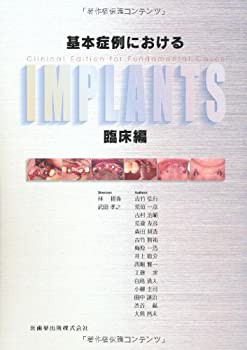 基本症例におけるIMPLANTS 臨床編(未使用 未開封の中古品)の通販は